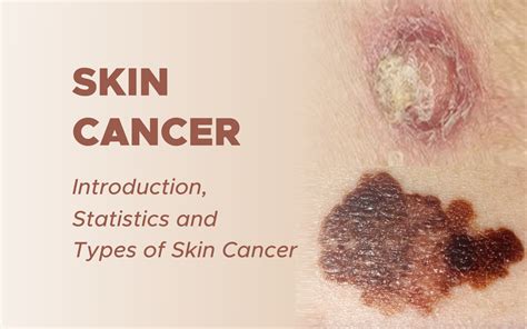 non melanoma skin cancer photos